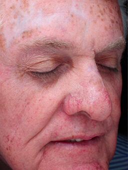 Case # 32 before photo