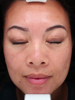 Case # 31 after photo