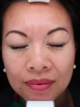 Case # 31 before photo