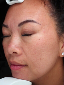 Case # 31 after photo