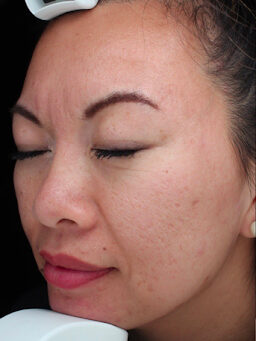 Case # 31 before photo