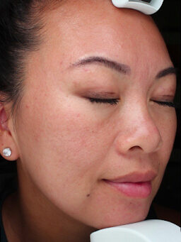 Case # 31 after photo