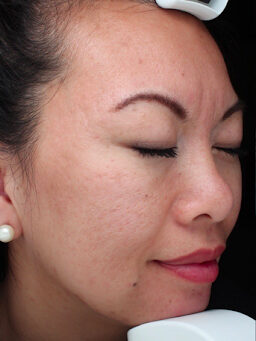 Case # 31 before photo