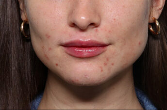 Case # 22 after photo