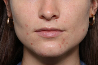 Case # 22 before photo