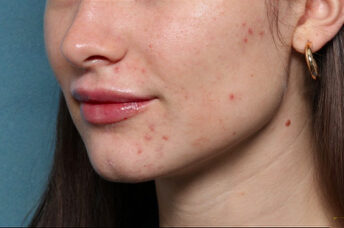 Case # 22 after photo