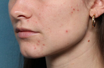 Case # 22 before photo