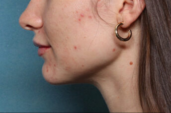 Case # 22 after photo