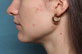 Case # 22 before photo