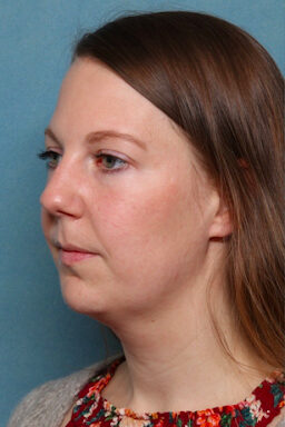 Case # 4 before photo