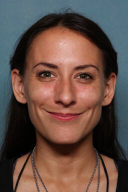 Case # 22 before photo