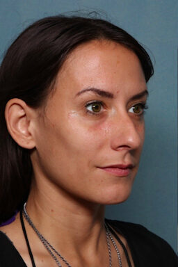 Case # 22 before photo