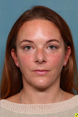 Case # 3 after photo