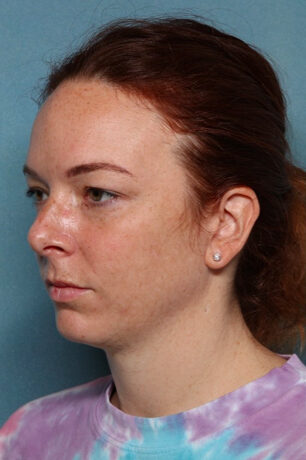 Case # 3 before photo