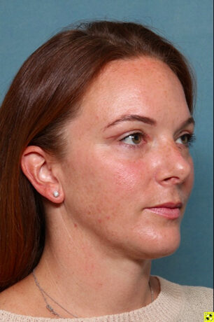 Case # 3 after photo