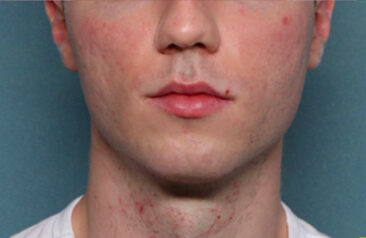 Case # 21 after photo