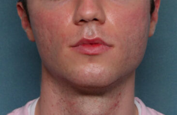 Case # 21 before photo