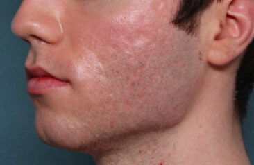 Case # 21 before photo