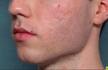 Case # 30 after photo