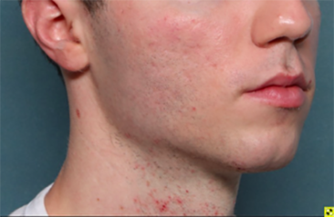 Case # 30 after photo