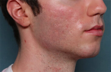 Case # 30 before photo