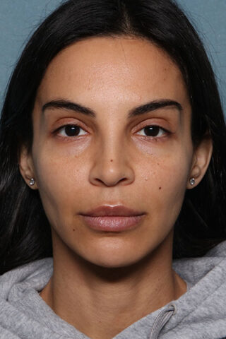 Case # 20 after photo