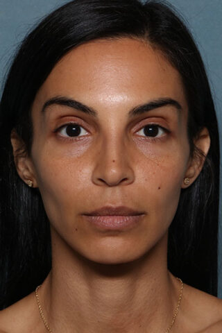 Case # 20 before photo