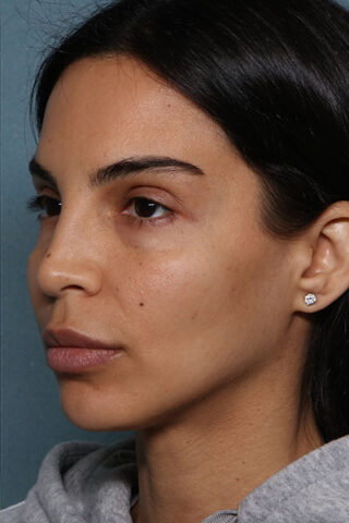 Case # 20 after photo