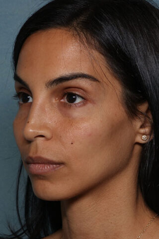 Case # 20 before photo