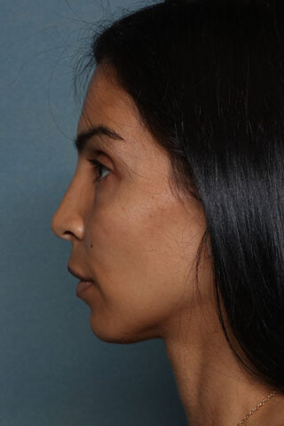 Case # 20 before photo