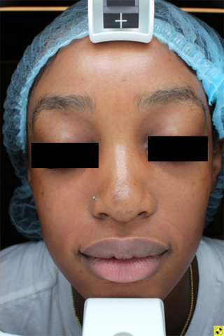 Case # 29 after photo