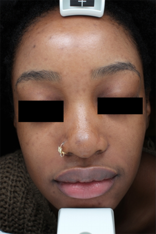 Case # 29 before photo