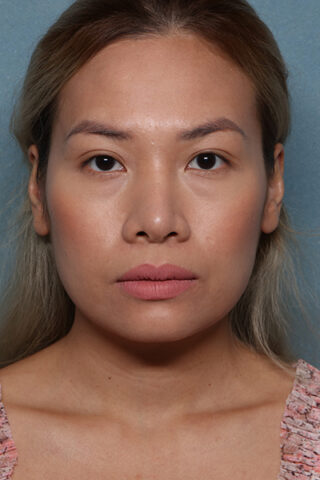 Case # 19 after photo