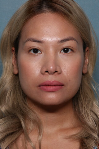 Case # 19 before photo