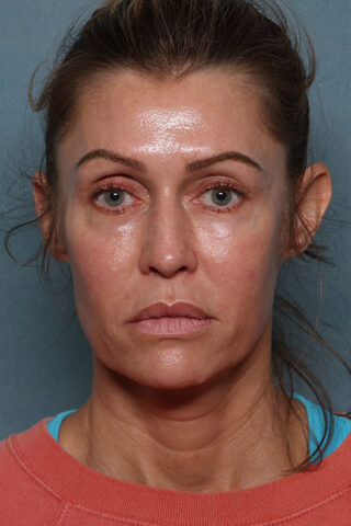 Case # 18 before photo