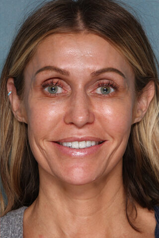 Case # 18 after photo