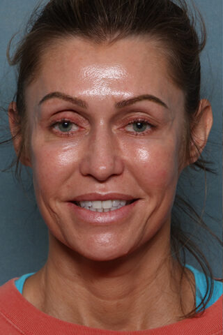 Case # 18 before photo