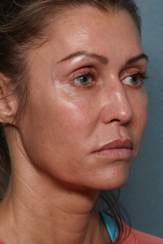 Case # 18 before photo