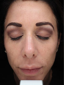 Case # 28 after photo