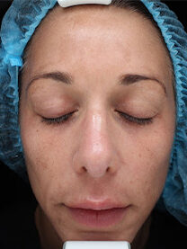 Case # 28 before photo