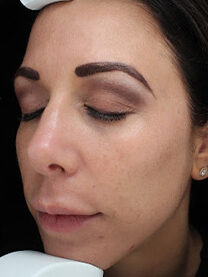 Case # 28 after photo