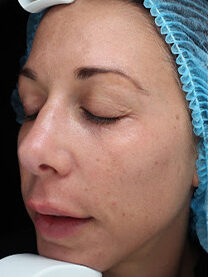 Case # 28 before photo