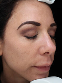 Case # 28 after photo