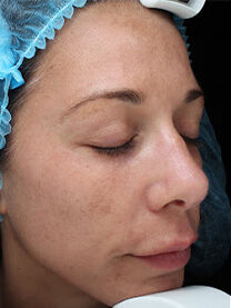 Case # 28 before photo