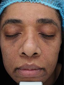 Case # 27 after photo