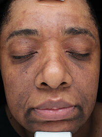 Case # 27 before photo