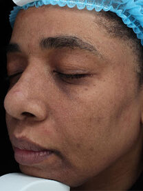 Case # 27 after photo