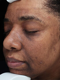 Case # 27 before photo