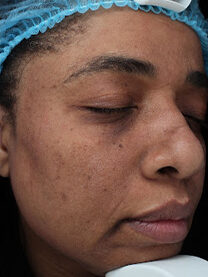 Case # 27 after photo