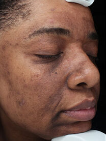 Case # 27 before photo